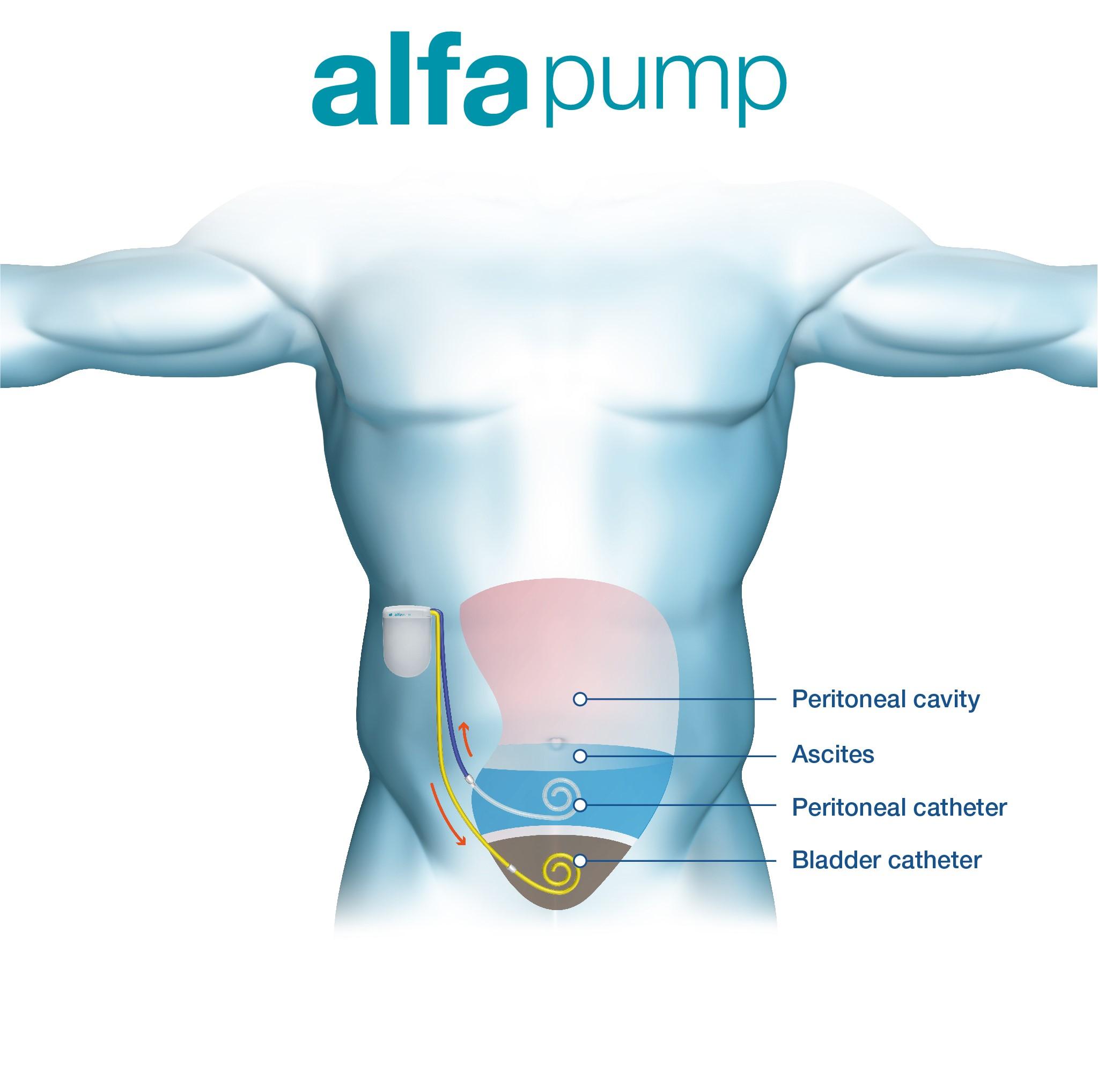 How it works? alfapump®